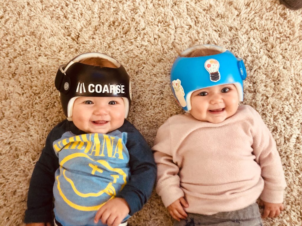 Twins and Plagiocephaly